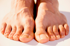 Gout and Feet