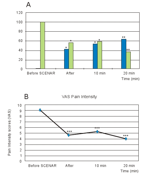 Scenar Pain Relief 2